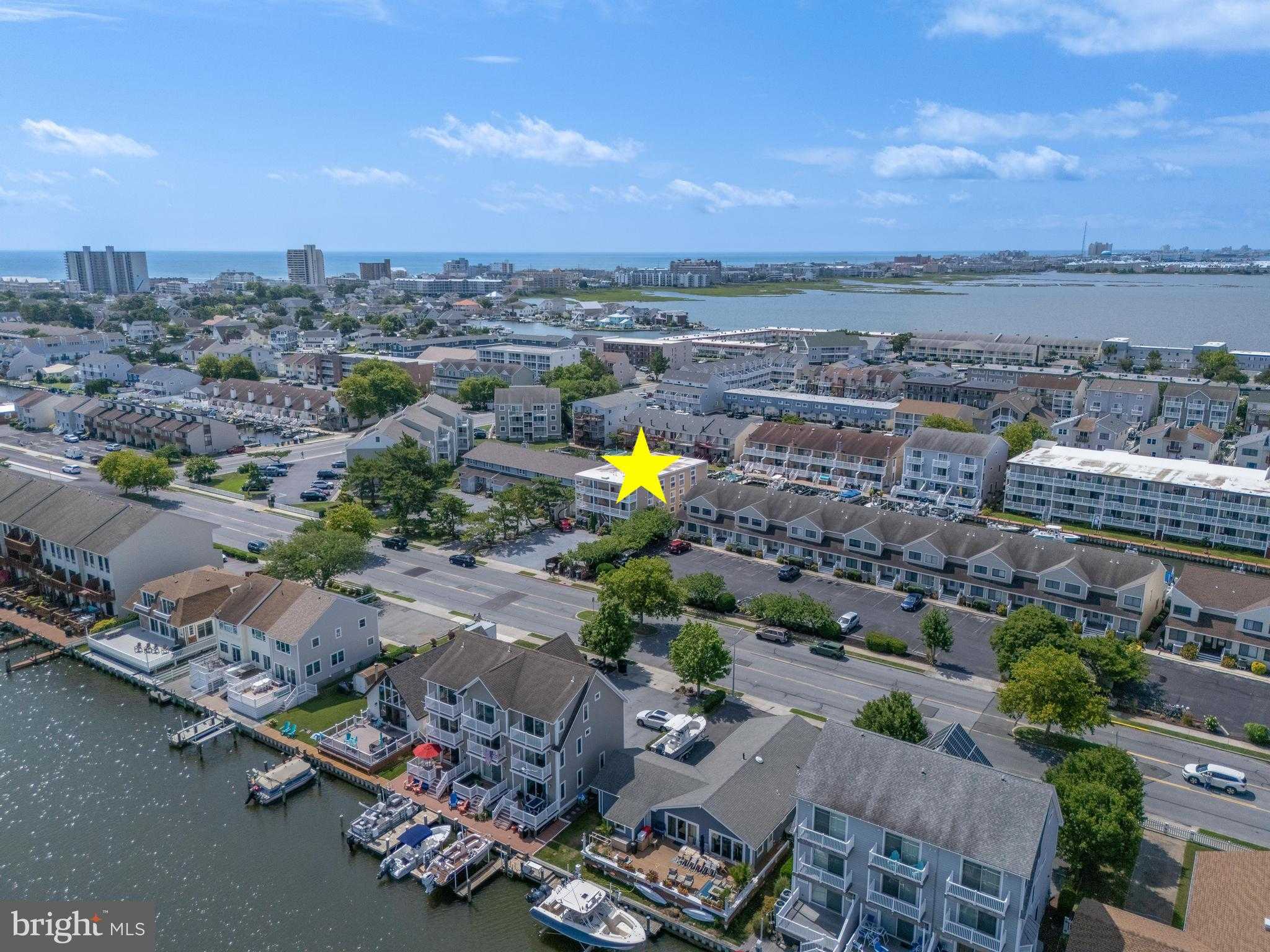 707 94th St Unit 302 photo 64