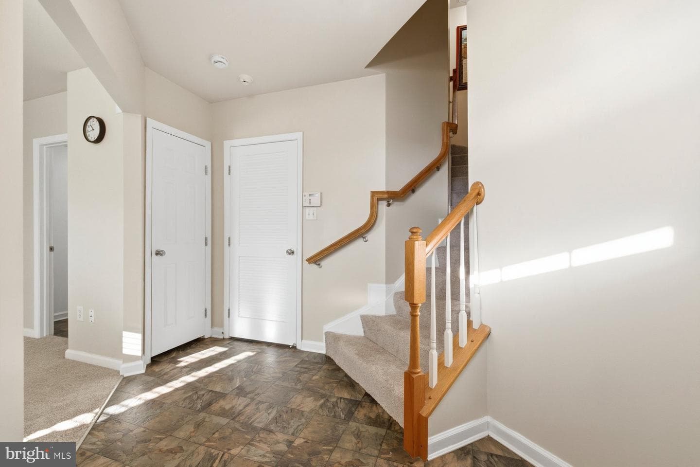 1017 Ironwood Lane photo 4