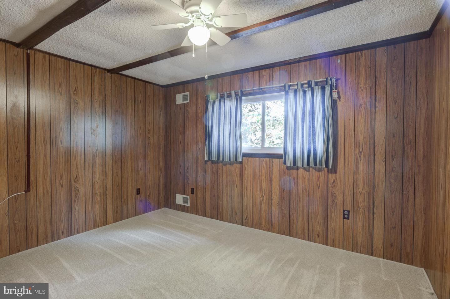 306 Ocean Parkway photo 8