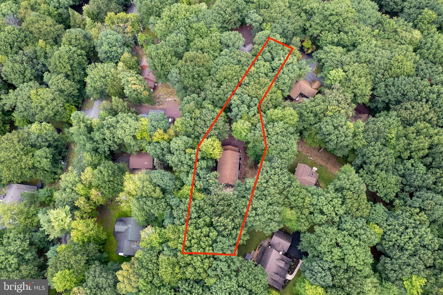 49 Forest Drive photo 86