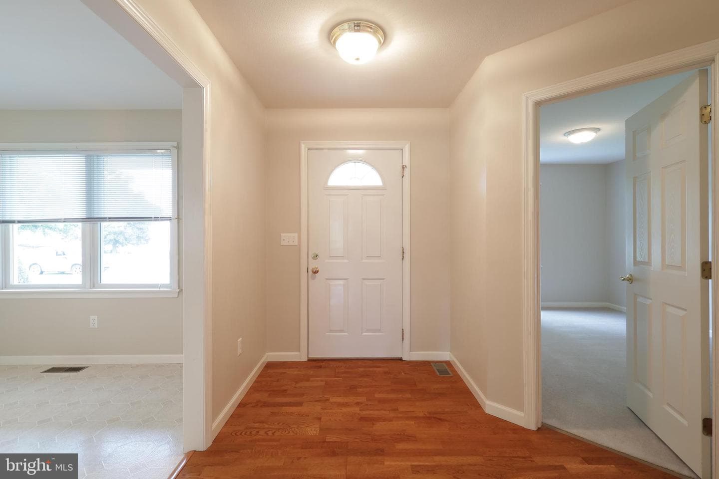 1110 E Springfield Drive photo 6