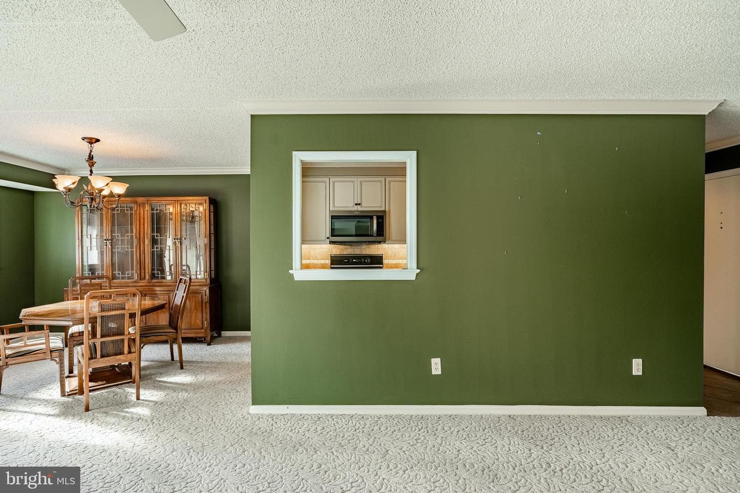 307 B000 Summit Drive ##b photo 9