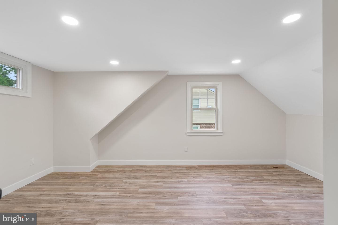 101 Overhill Avenue photo 18