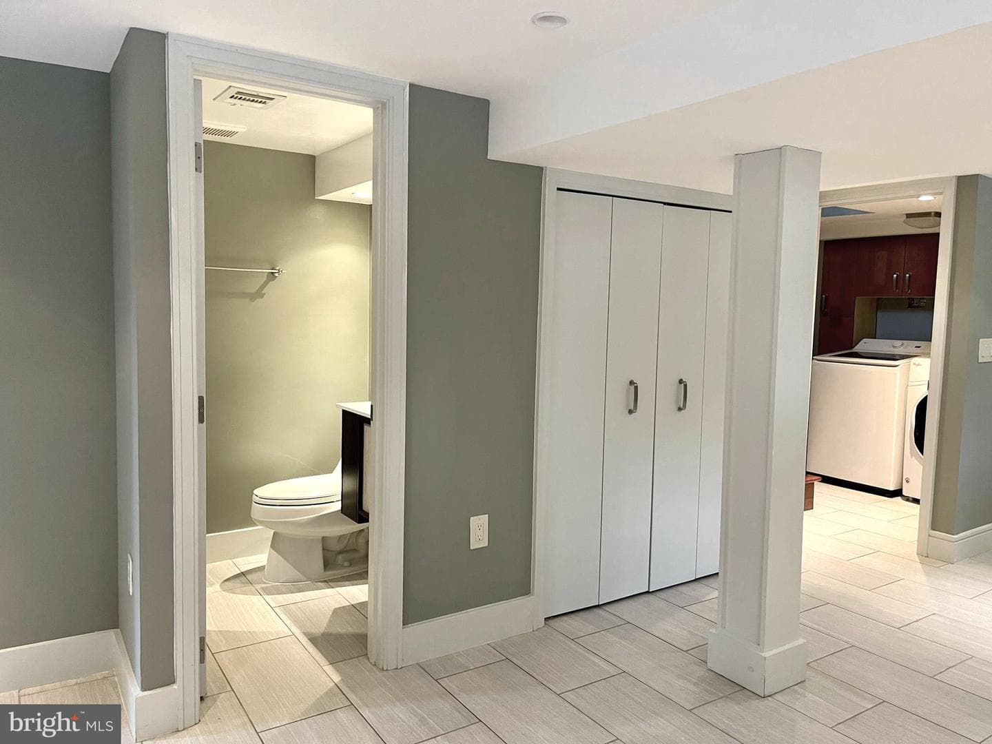 5 Custis Avenue E photo 37
