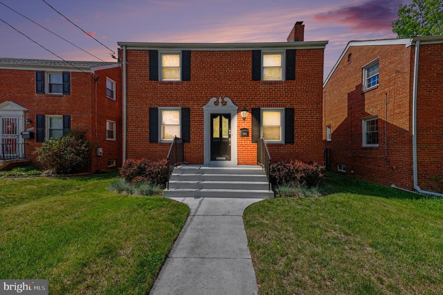 4504 20th Street NE photo 3