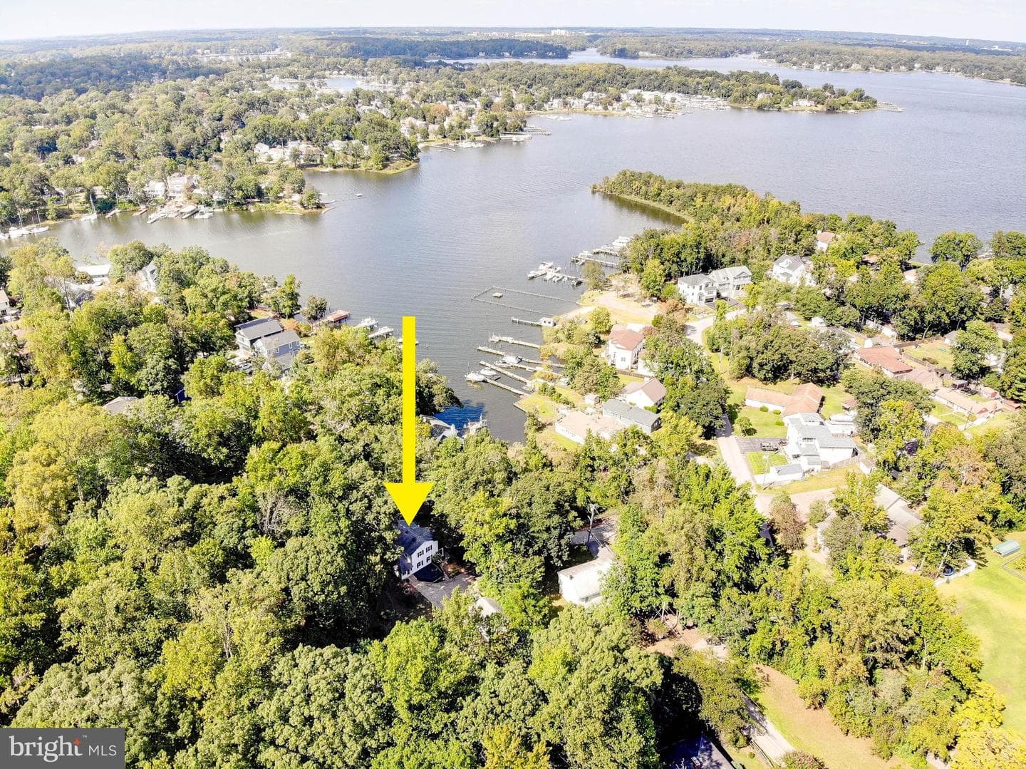 349 Arbutus Drive photo 66