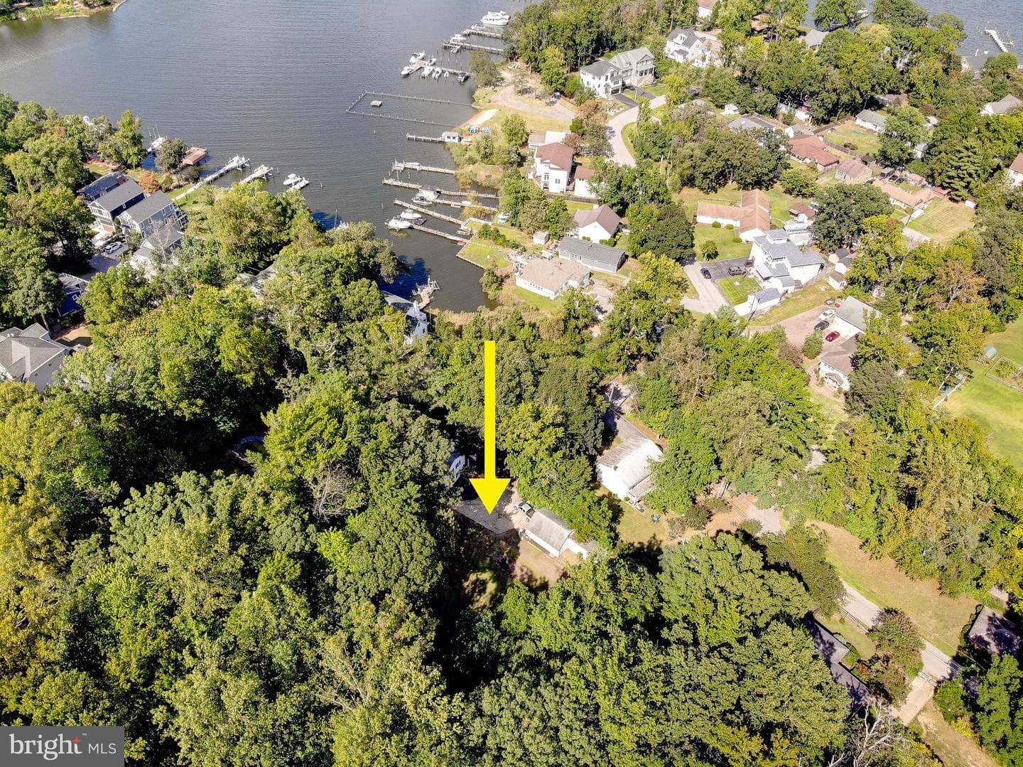 349 Arbutus Drive photo 67