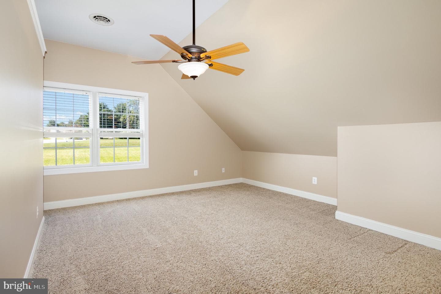 56 Sylmar Road photo 30