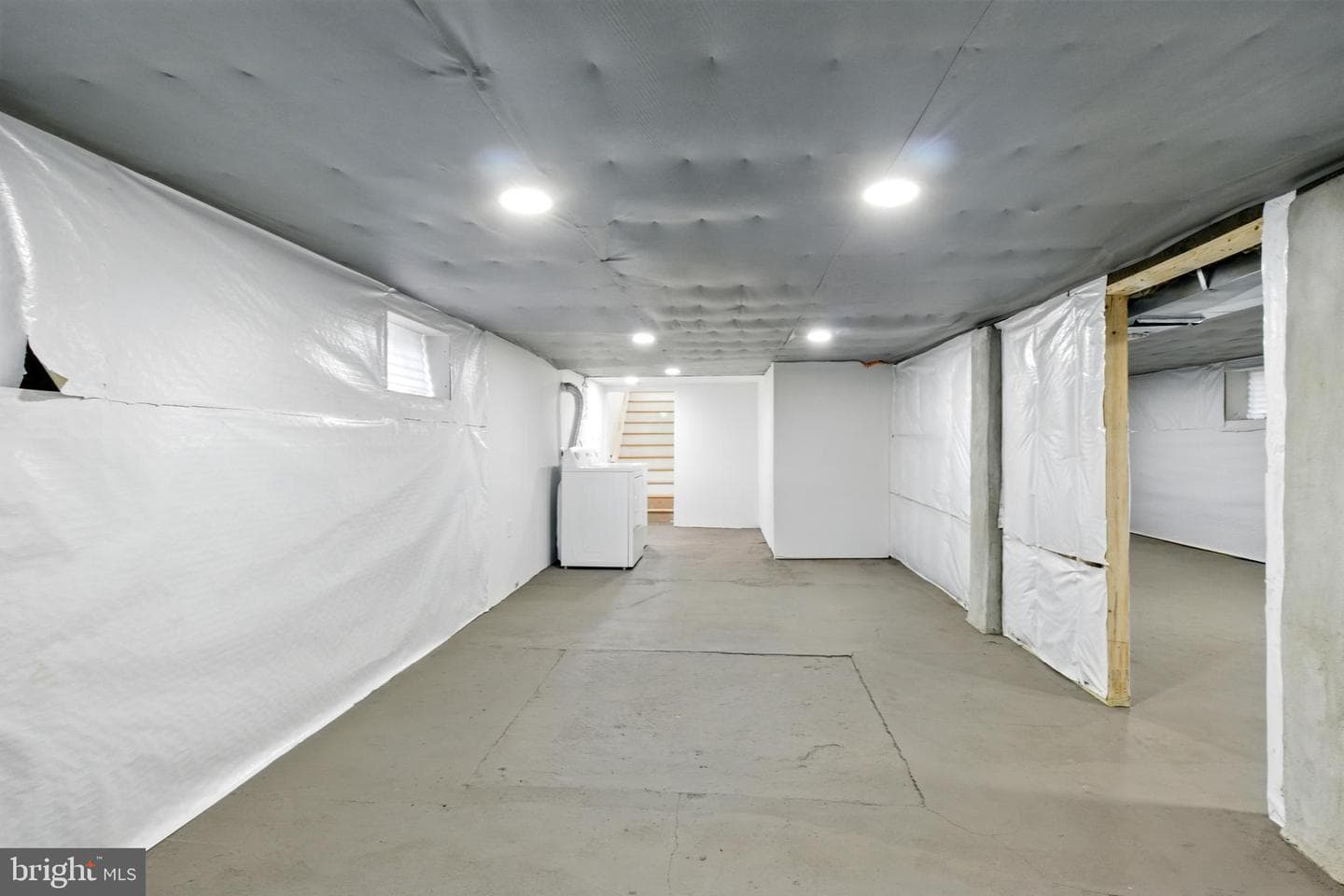 301 70th Street photo 25
