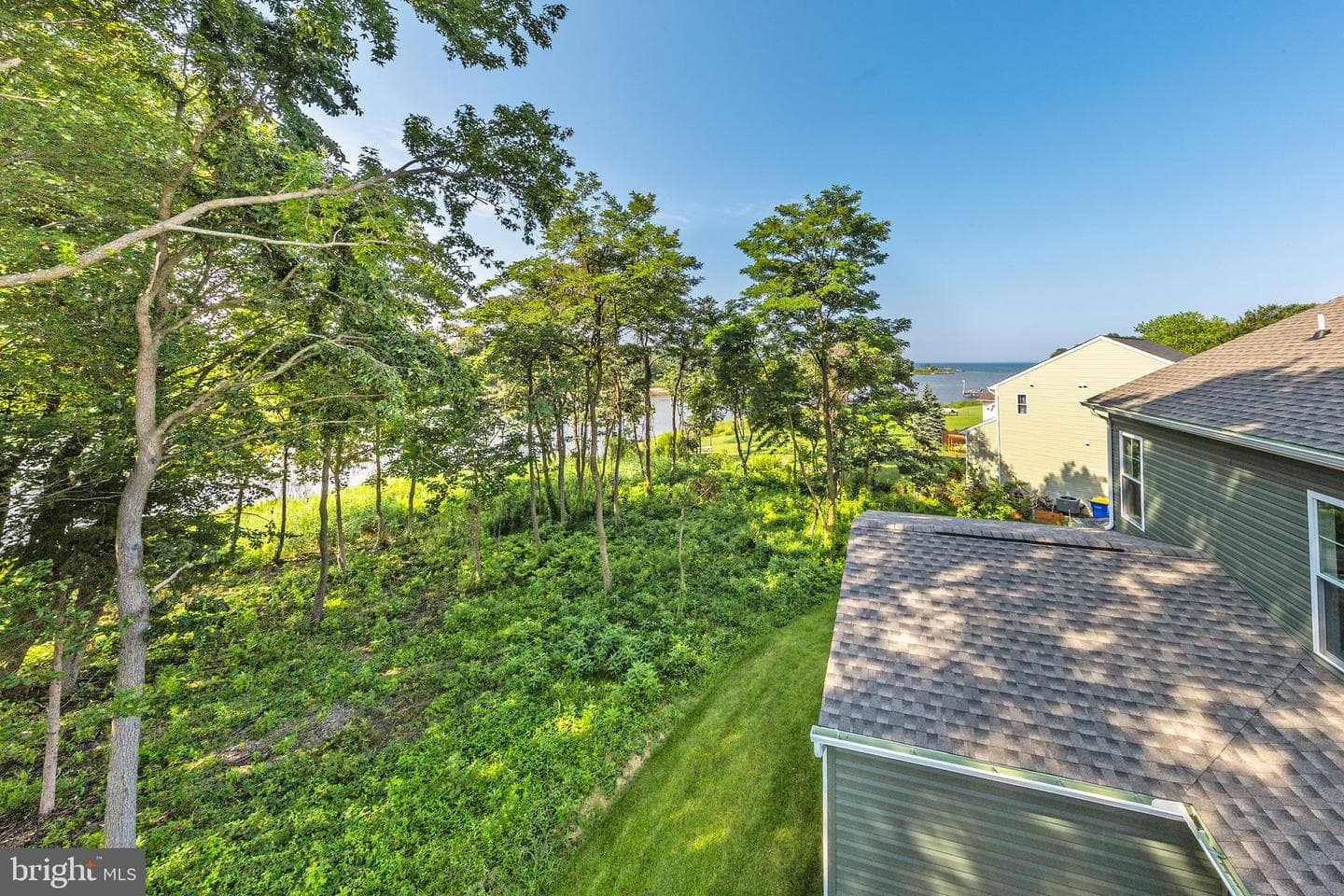 305 N Lake photo 82