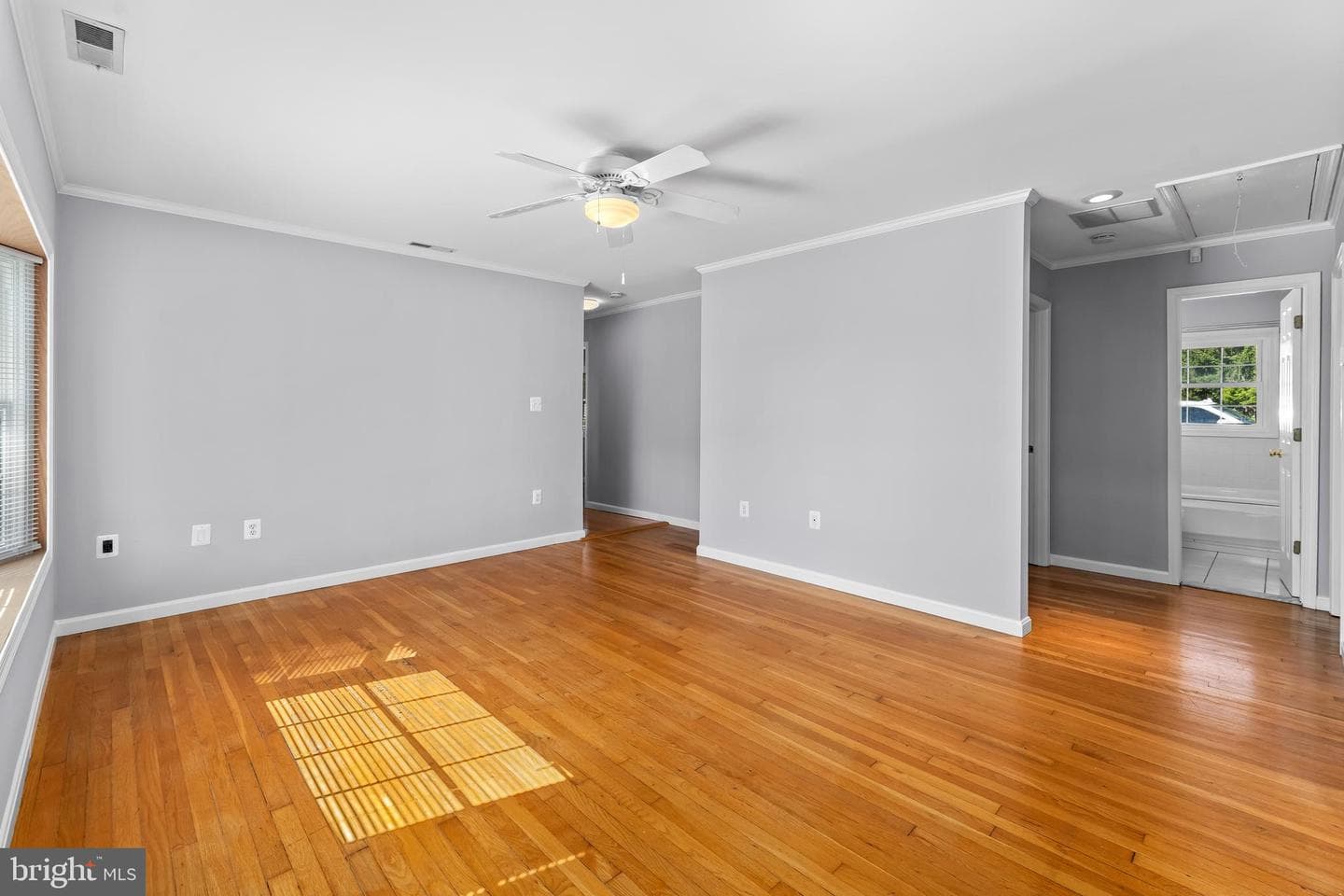 101 Queen Anne Road photo 8