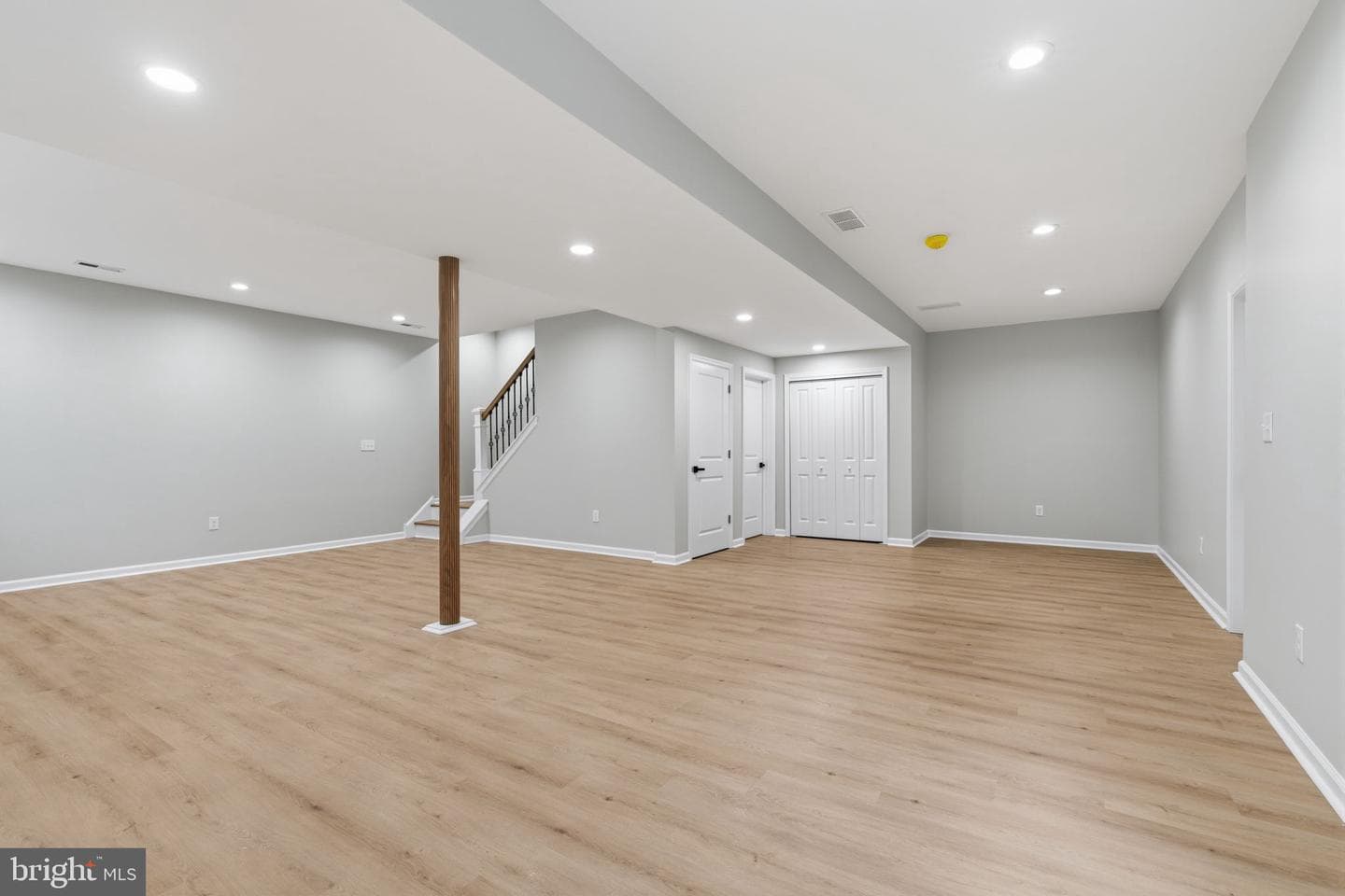 151 E Highland Avenue photo 29
