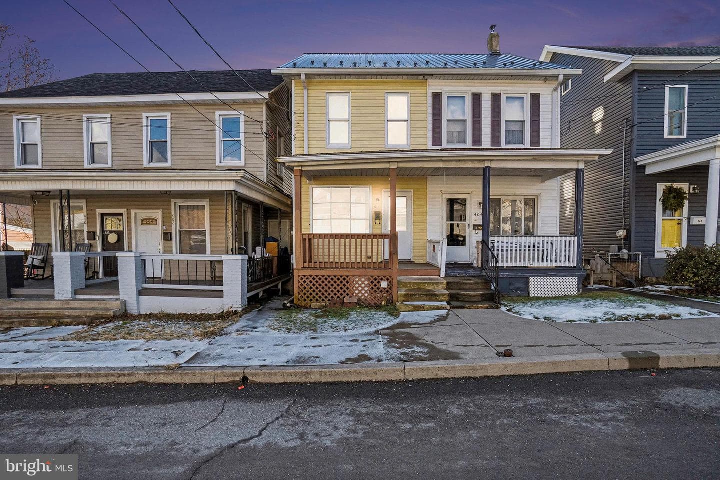 406 E Wiconisco Avenue photo 24
