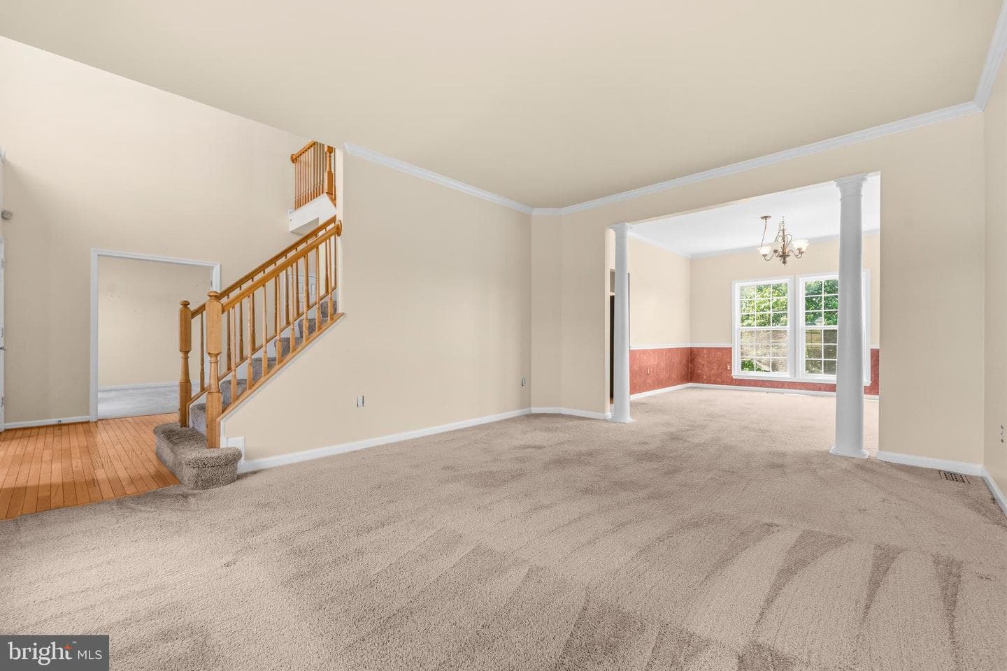 300 Spruce Hill Way photo 10